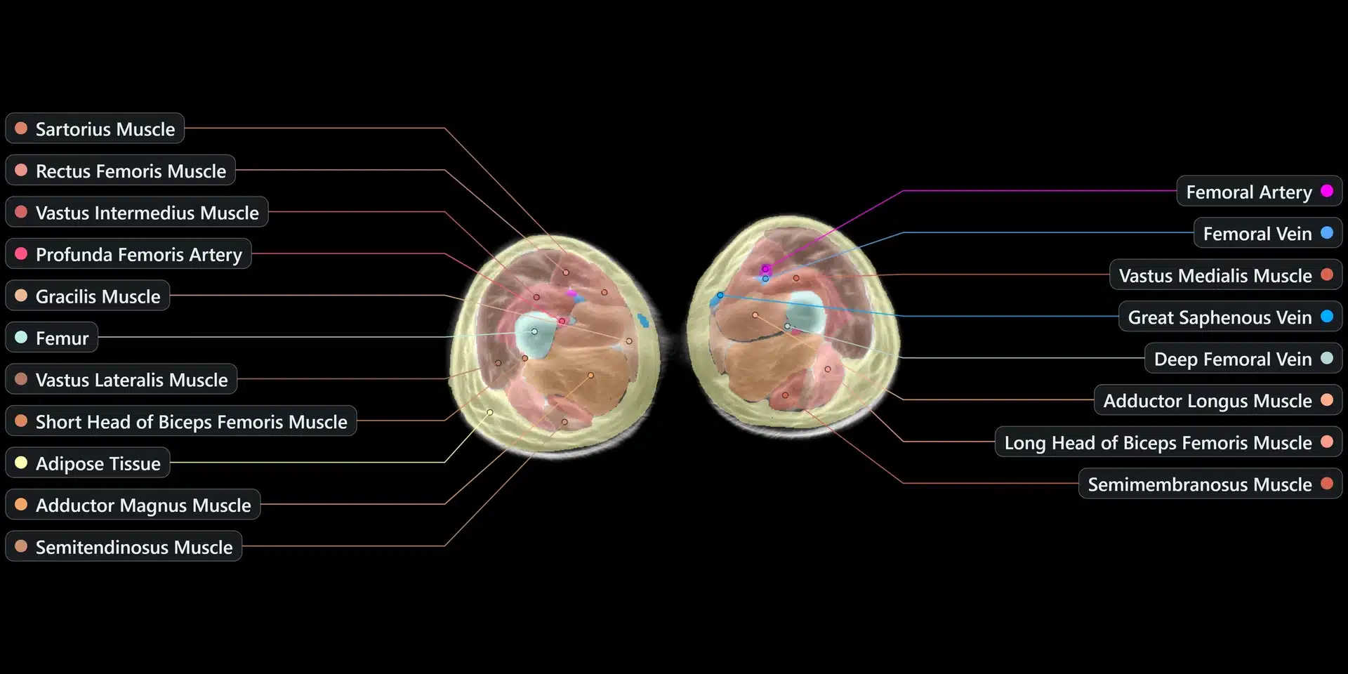 Midjourney Scanner